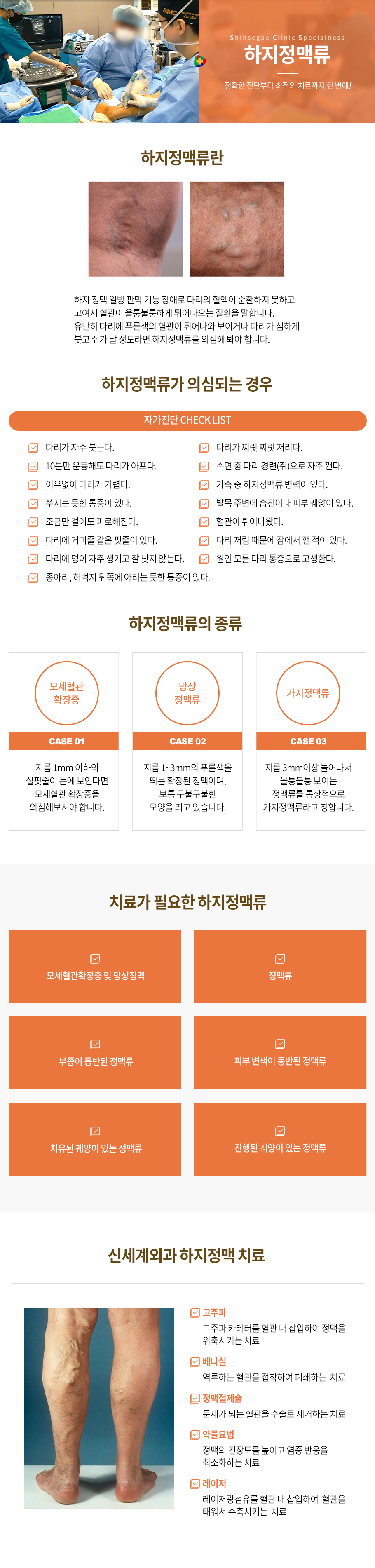 하지정맥수술