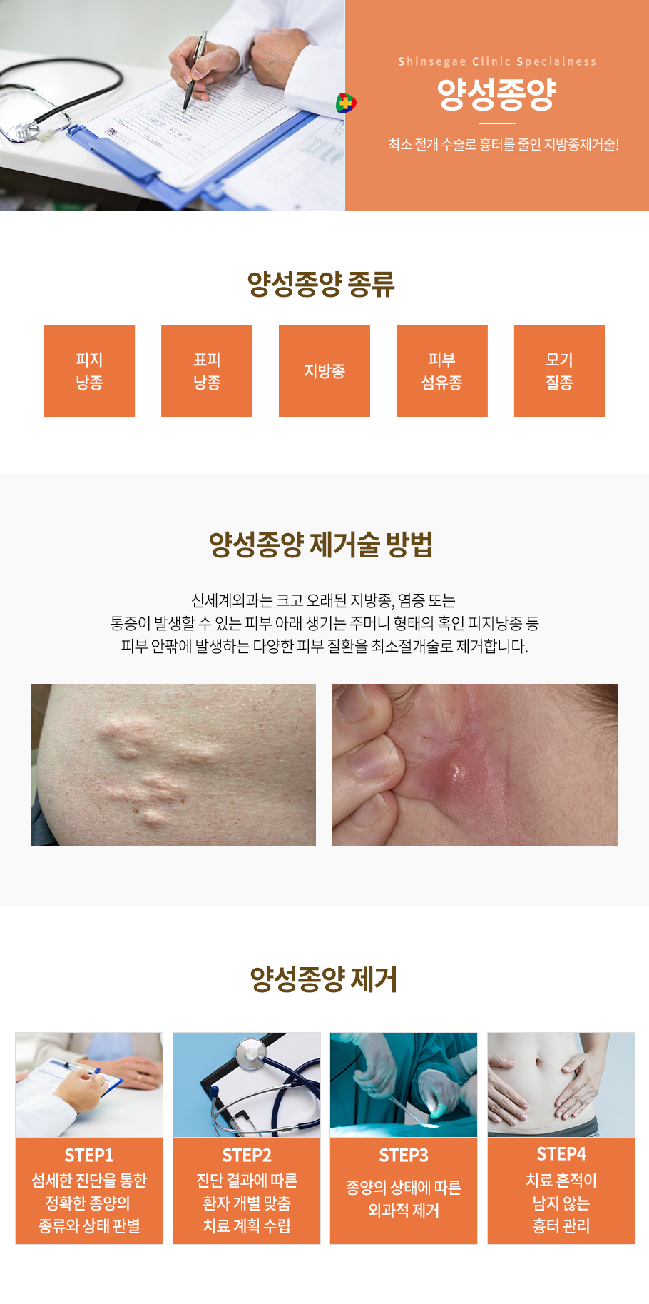담낭절제술