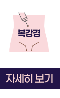 복강경