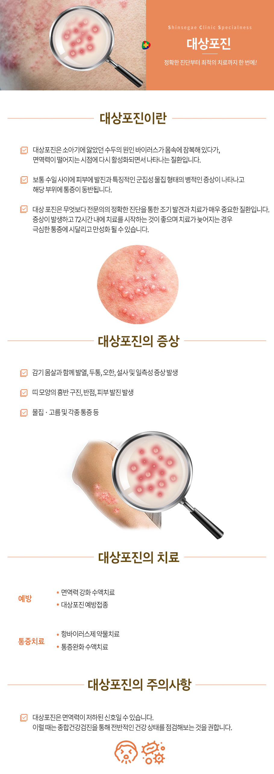 대상포진
