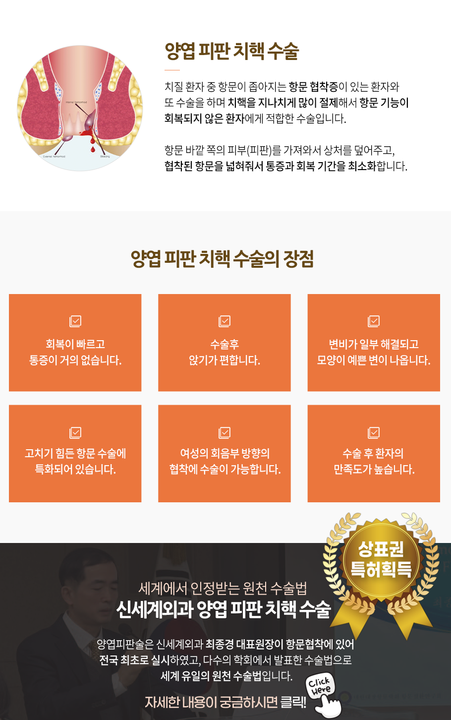 치핵