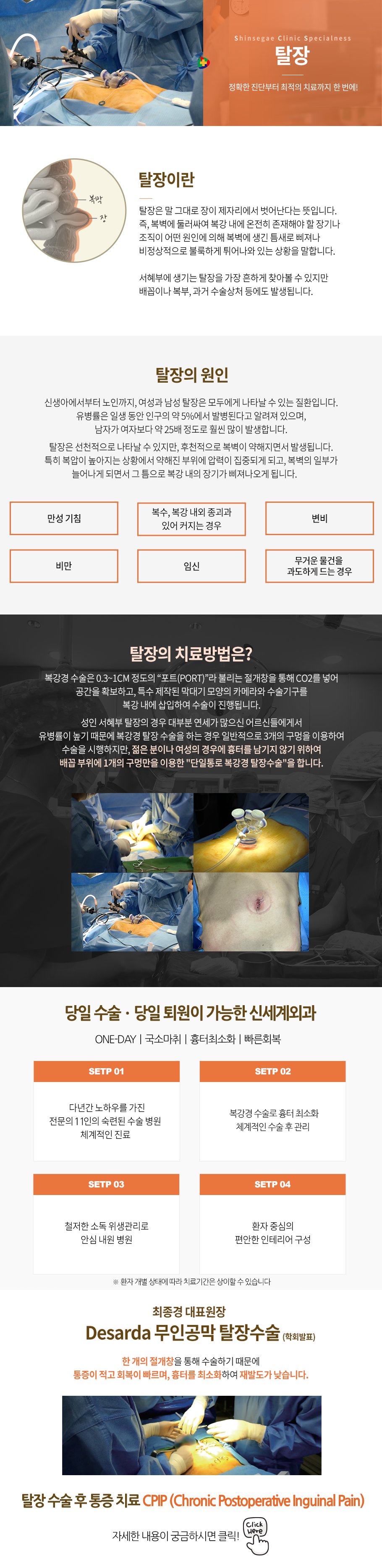 탈장